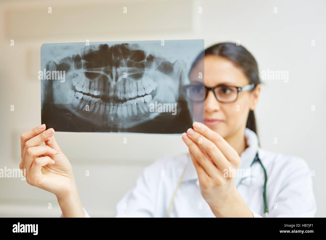 Xray image of denture in dentist office holded by doctor Stock Photo