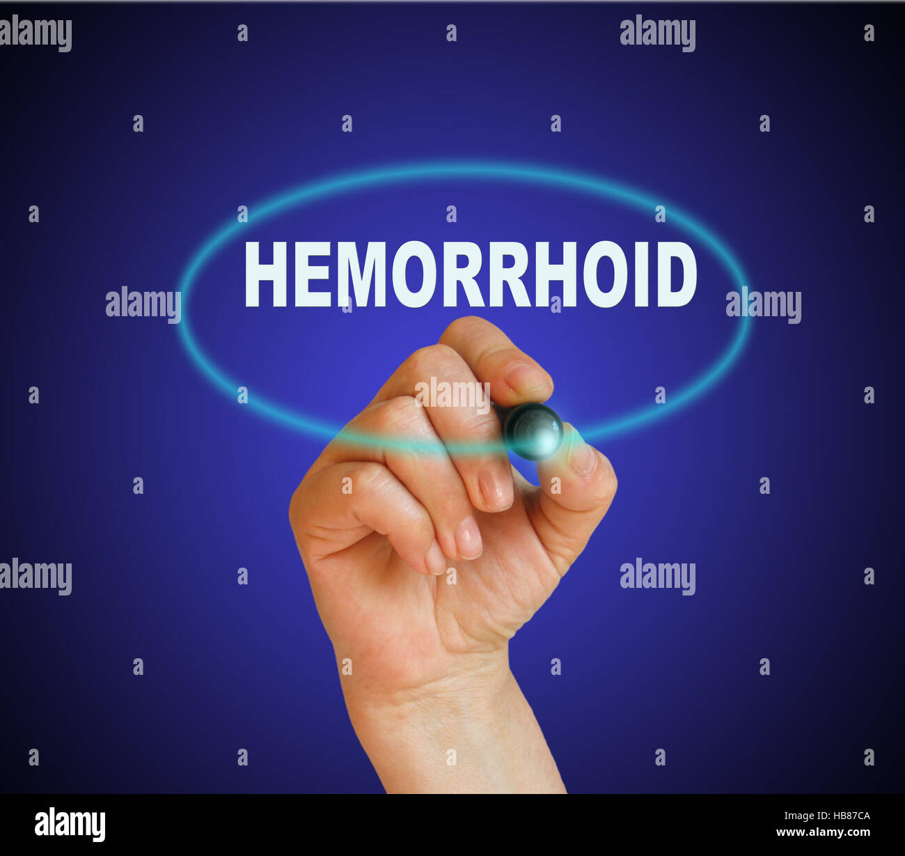 hemorrhoid Stock Photo Alamy