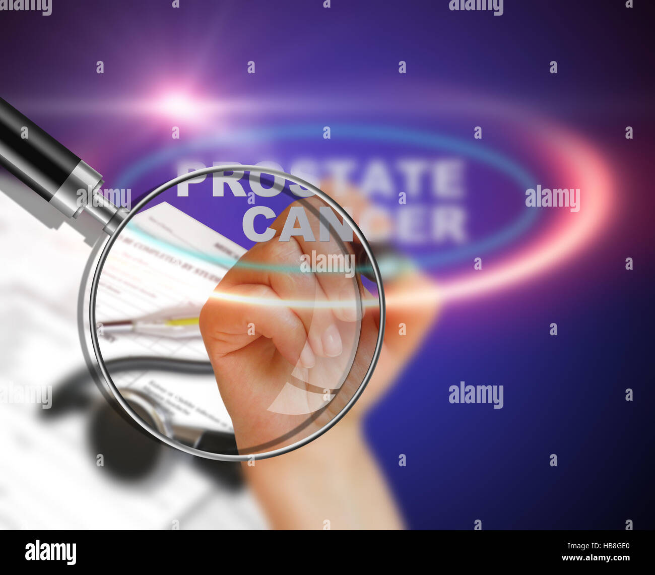 PROSTATE CANCER Stock Photo