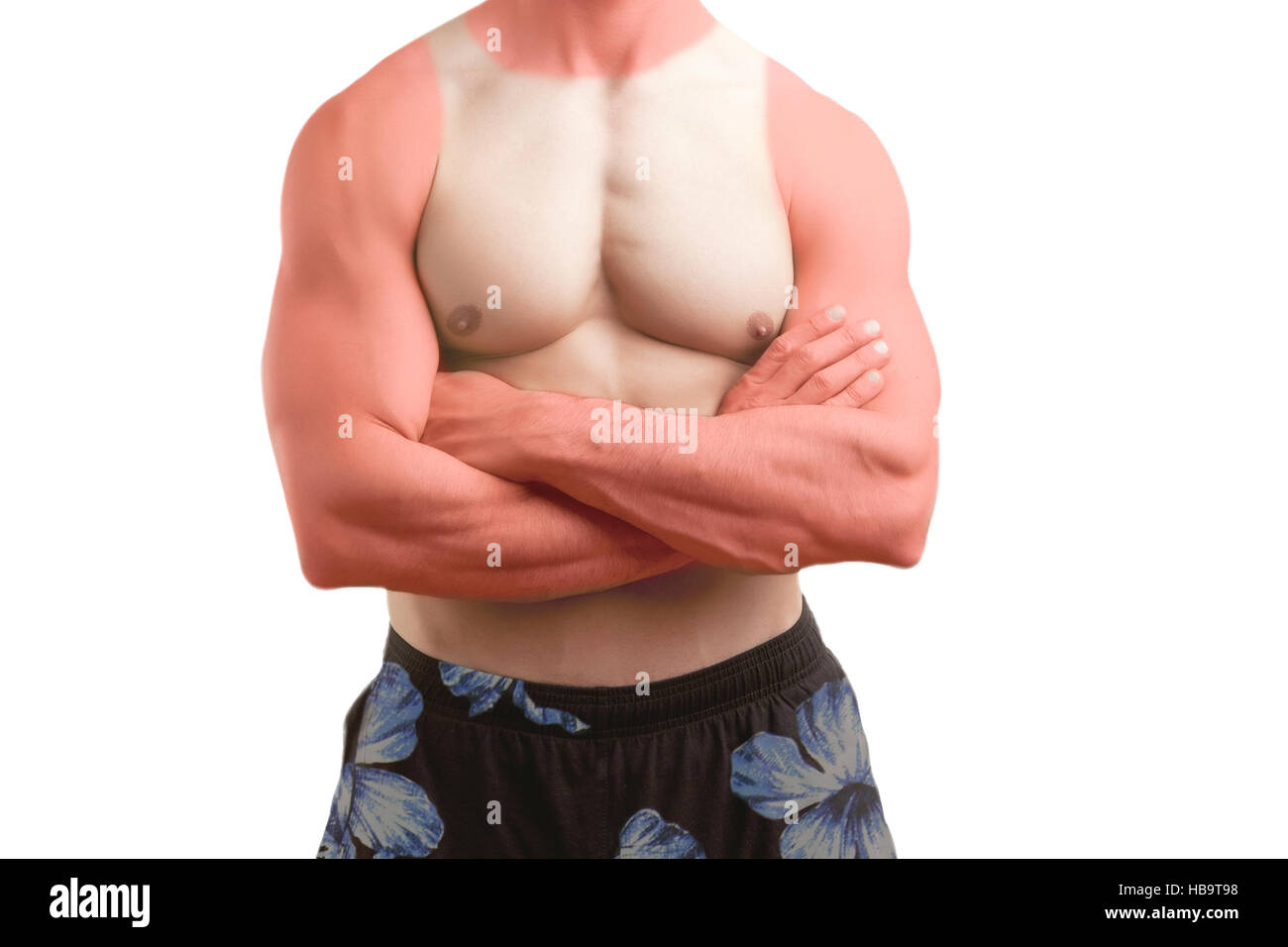 Fit Man Standing in a Beach With a Sunburn Stock Photo