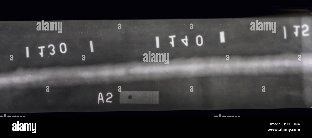 What Is A Pipeline X Ray? _ Pipe Inspection with Digital Radiography – DYHZ