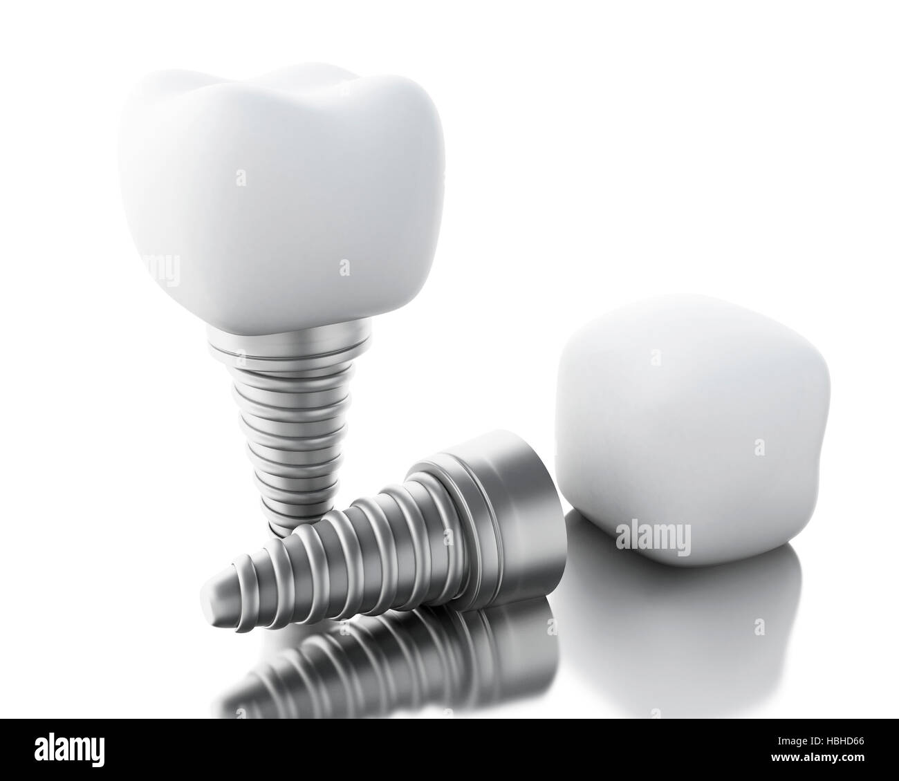 3D Illustration. Dental tooth implant. Dental care concept. Isolated white background. Stock Photo