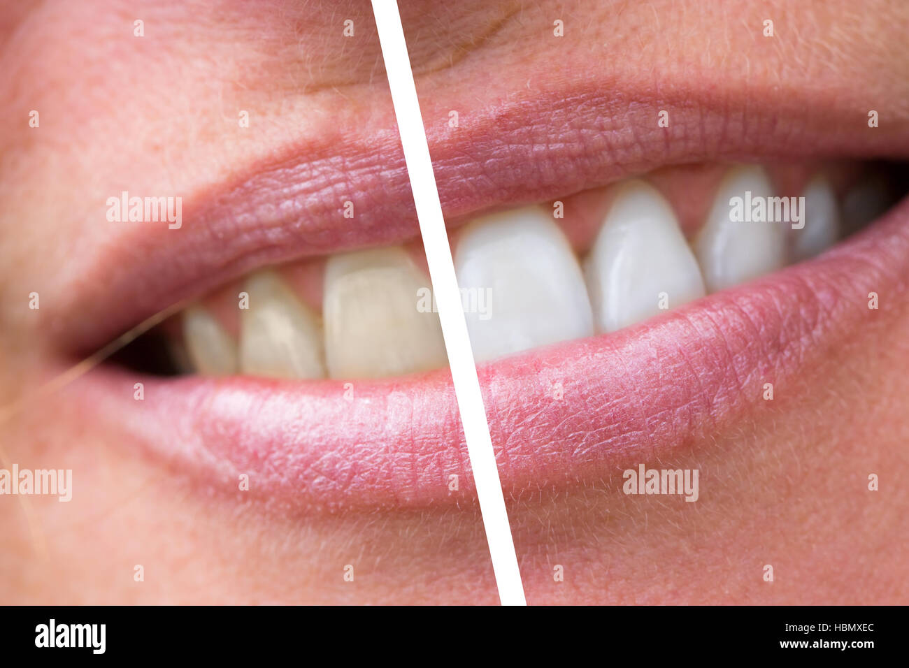 Teeth Before And After Stock Photos & Teeth Before And After Stock