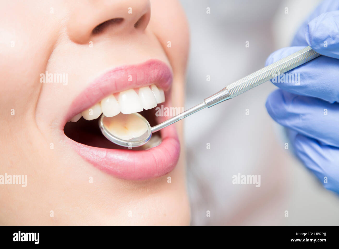 Close up view of open mouth during oral checkup at the dentist Stock Photo