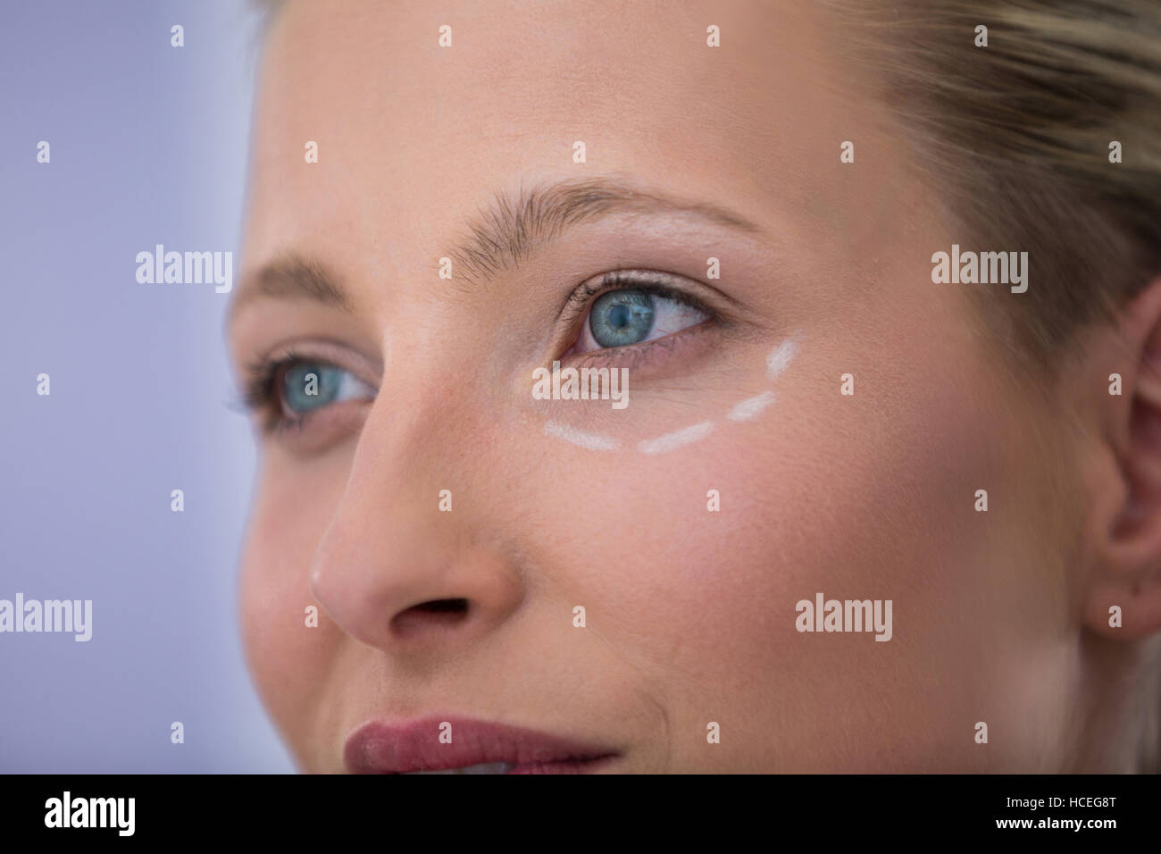 Woman with marks drawn for cosmetic treatment Stock Photo