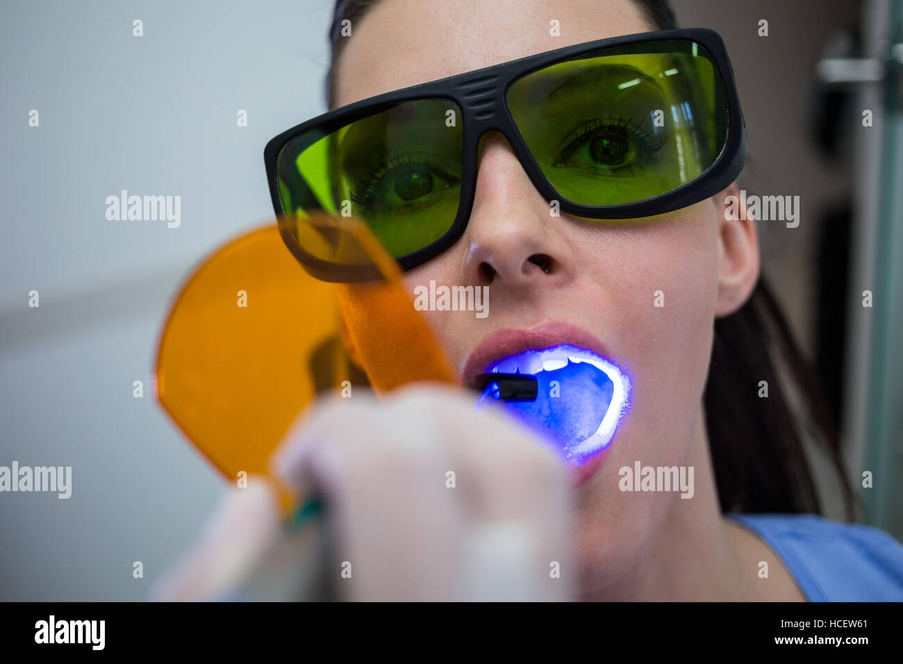 Dental curing light hires stock photography and images Alamy