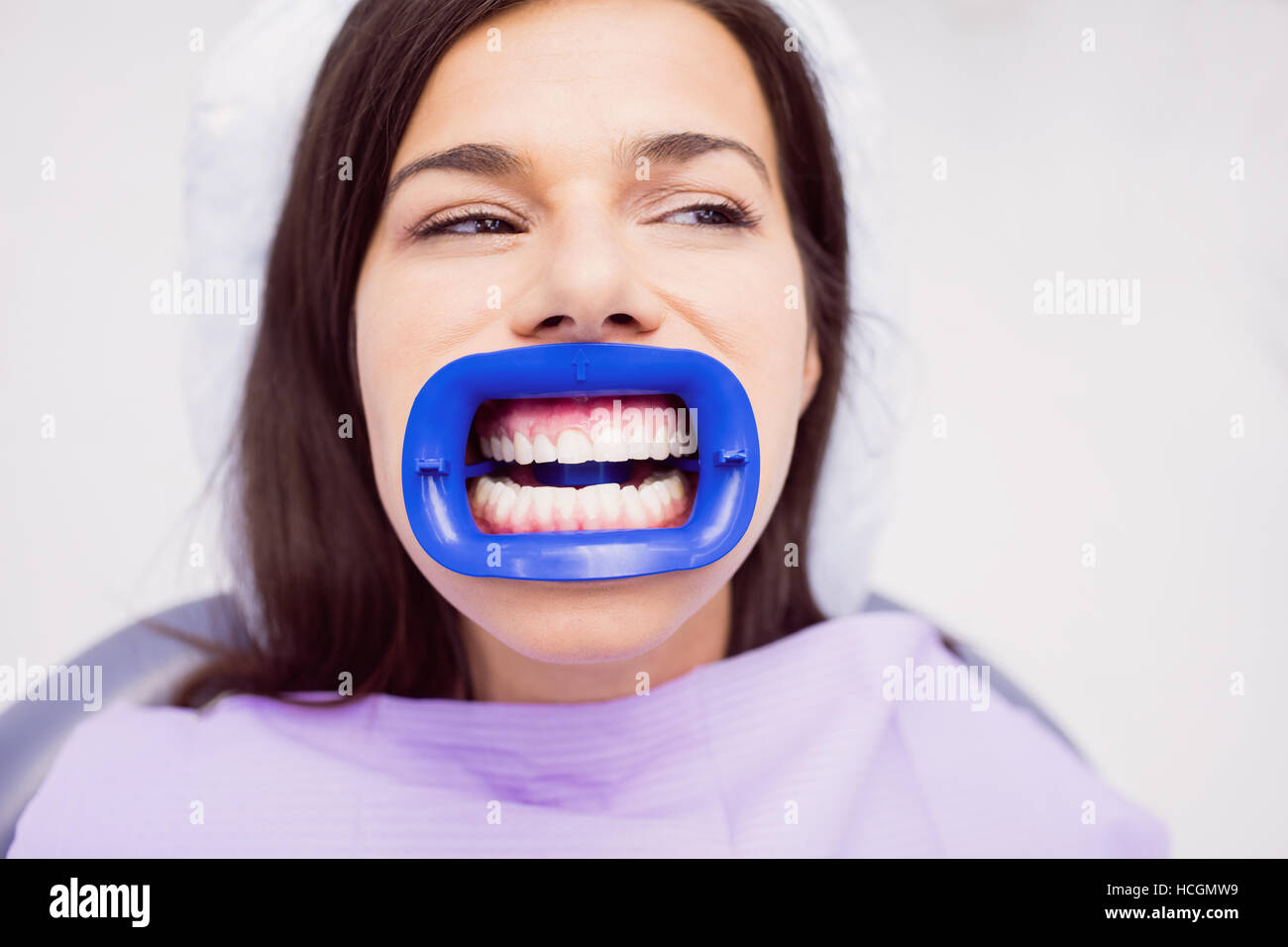 Dental_treatment hires stock photography and images Alamy