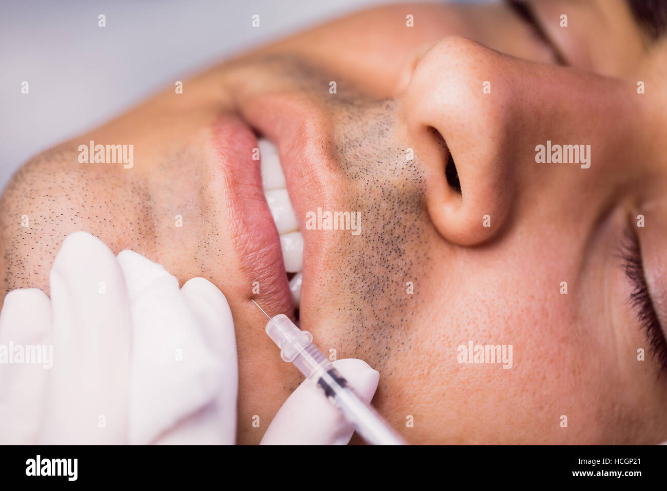 Man receiving botox injection on his lips Stock Photo