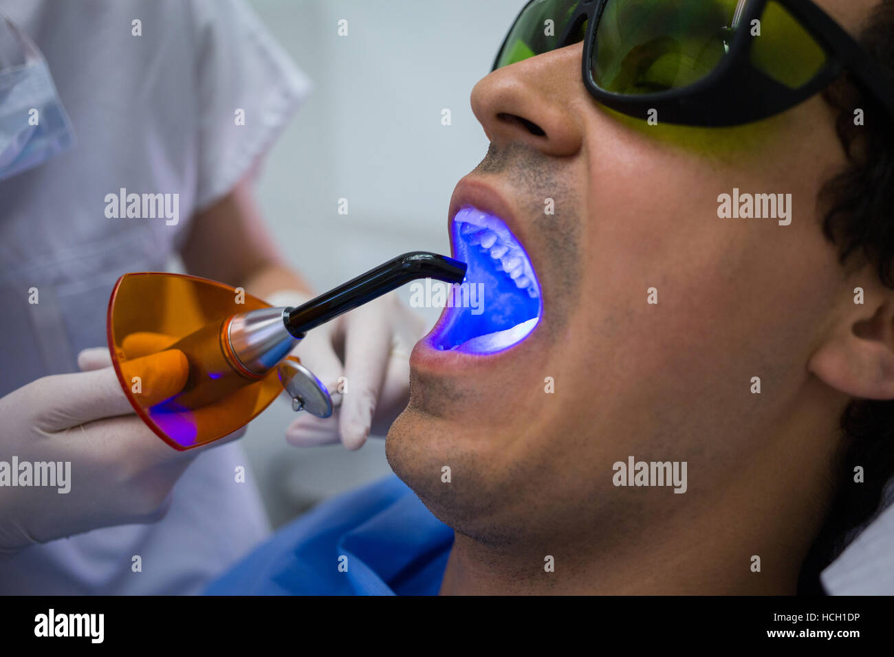Dentist examining patients teeth with dental curing light Stock Photo ...
