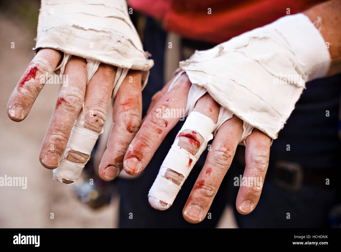 A close up of Brad Potter's bloody, worn down fingers after climbing a crack in Joshua Tree, CA. Stock Photo