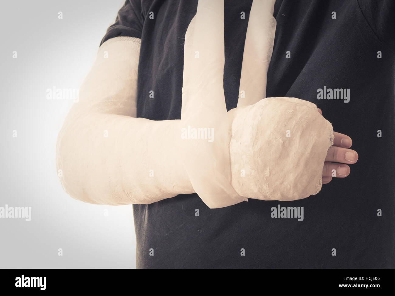 Arm cast Cut Out Stock Images & Pictures - Alamy