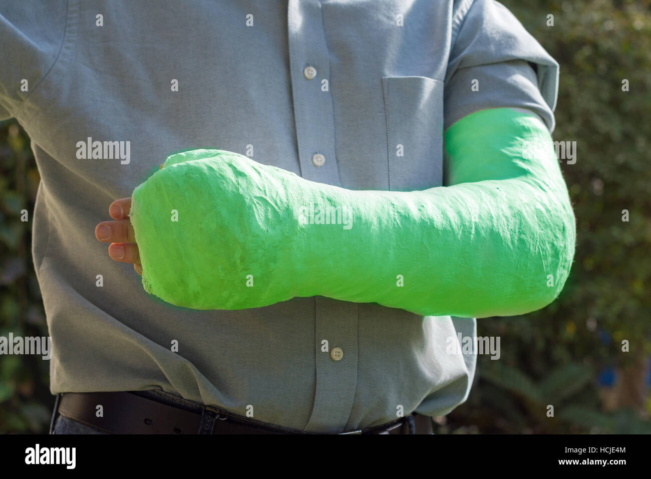 An arm and elbow in a green plaster / fiberglass cast worn by a young man standing in a garden Stock Photo