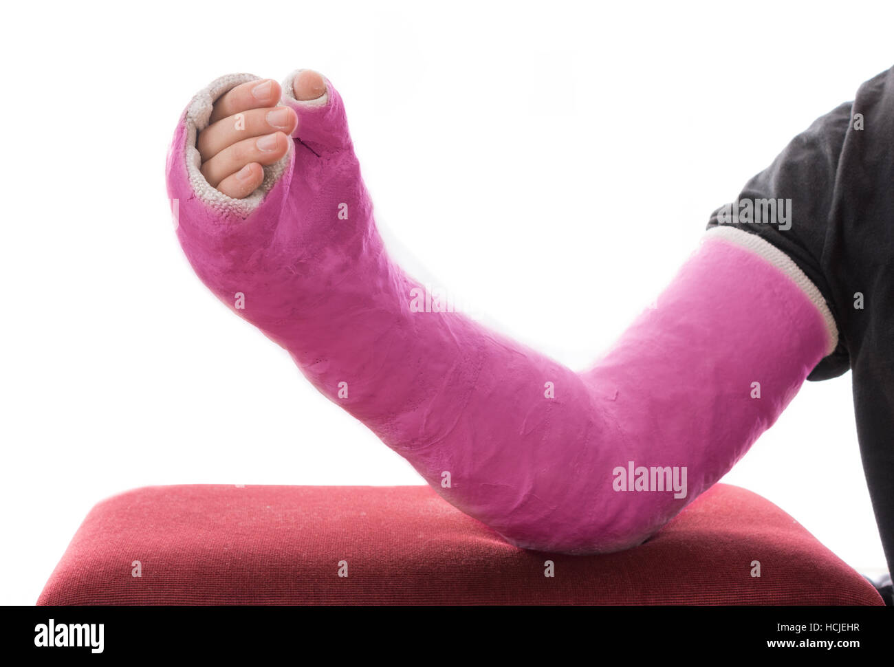 A pink long arm plaster / fiberglass cast covering the wrist, arm, and  elbow, resting on an ottoman, isolated on white Stock Photo - Alamy