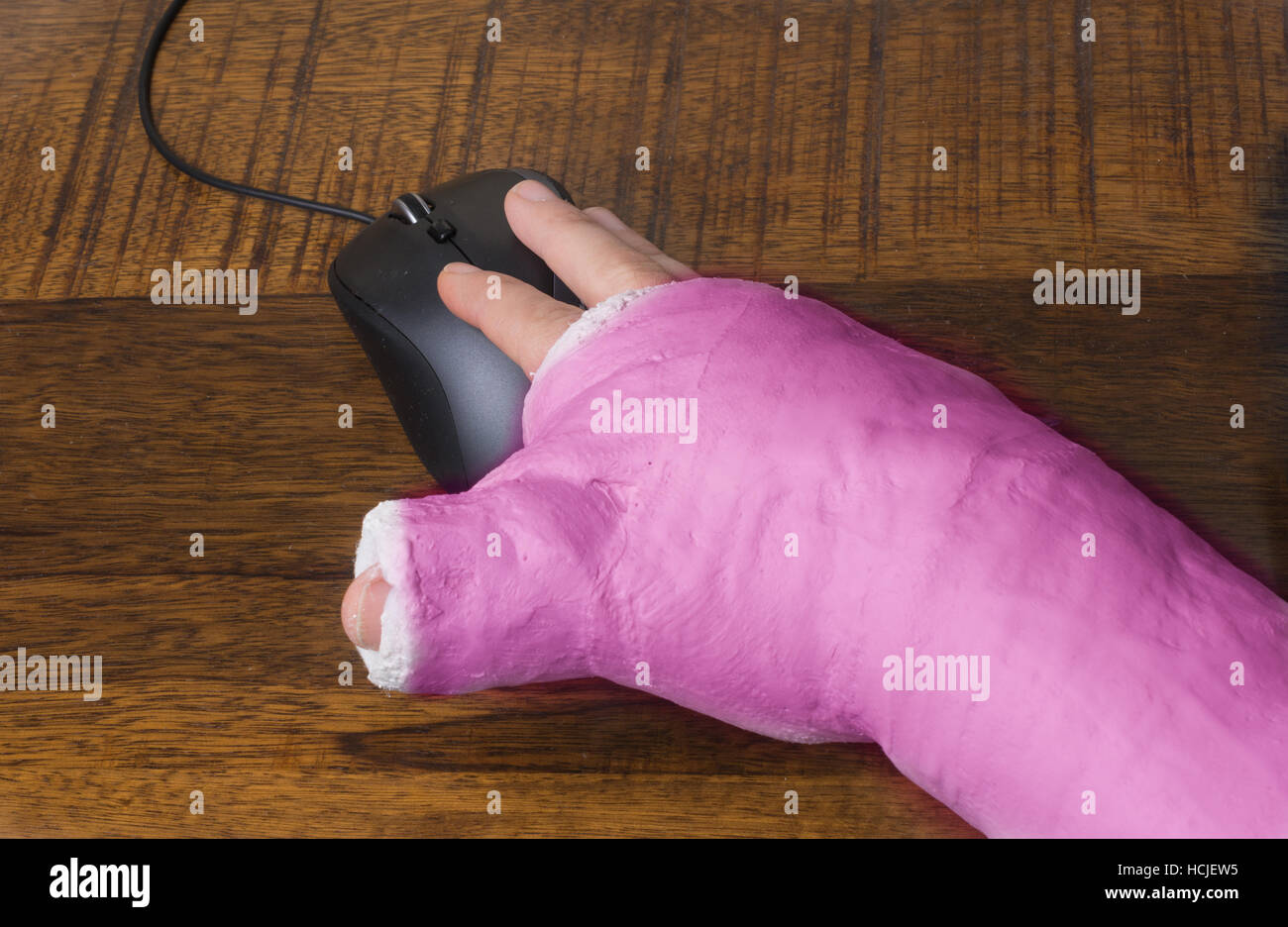 A person wearing an arm cast after breaking their wrist having difficulty using a computer mouse Stock Photo