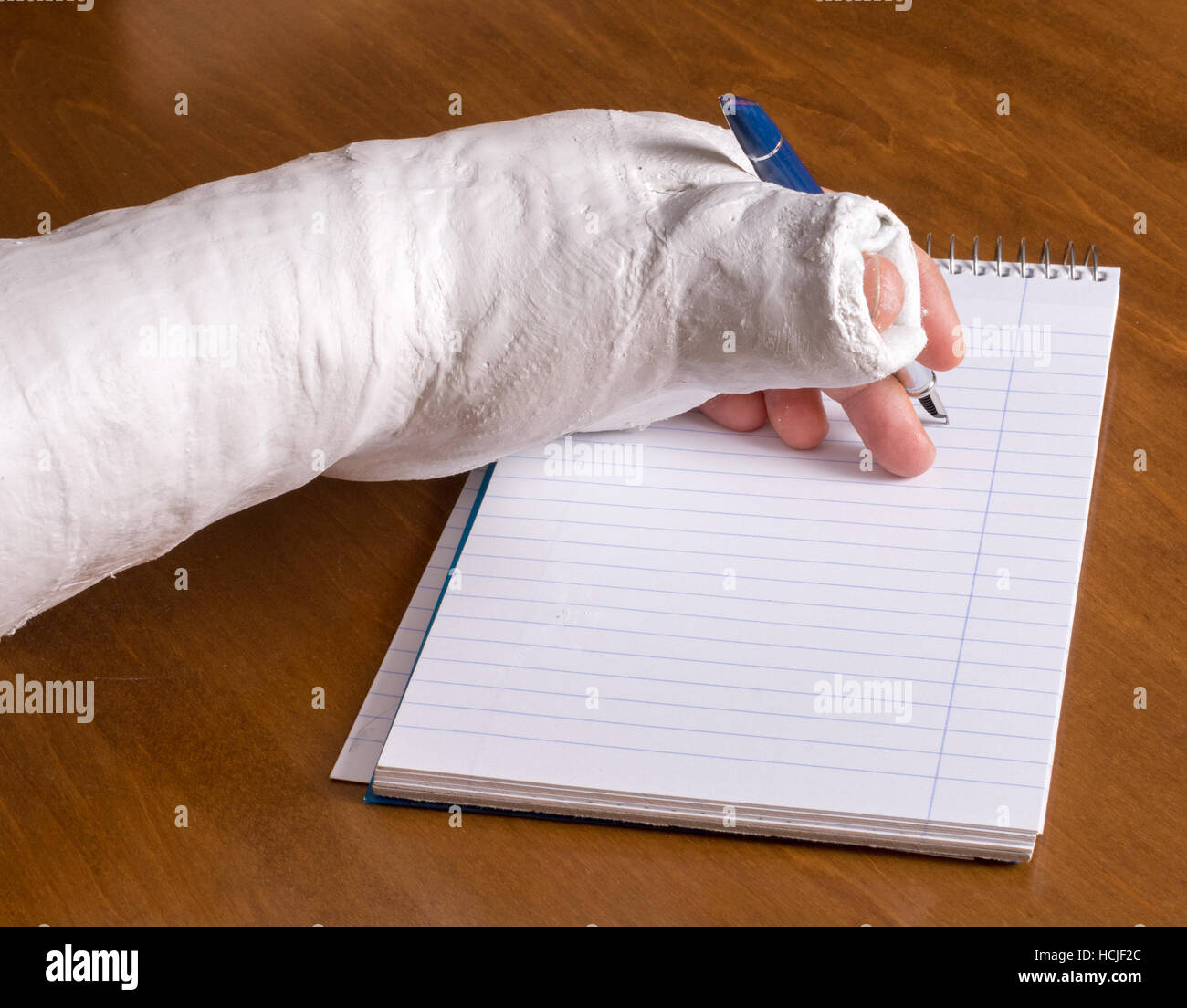 Person wearing an arm cast after breaking their wrist trying to write a note on a piece of paper Stock Photo