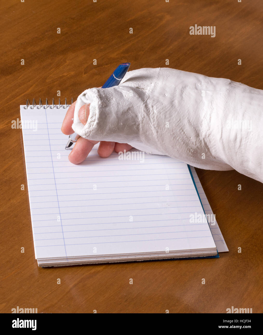 Broken arm personal narrative image