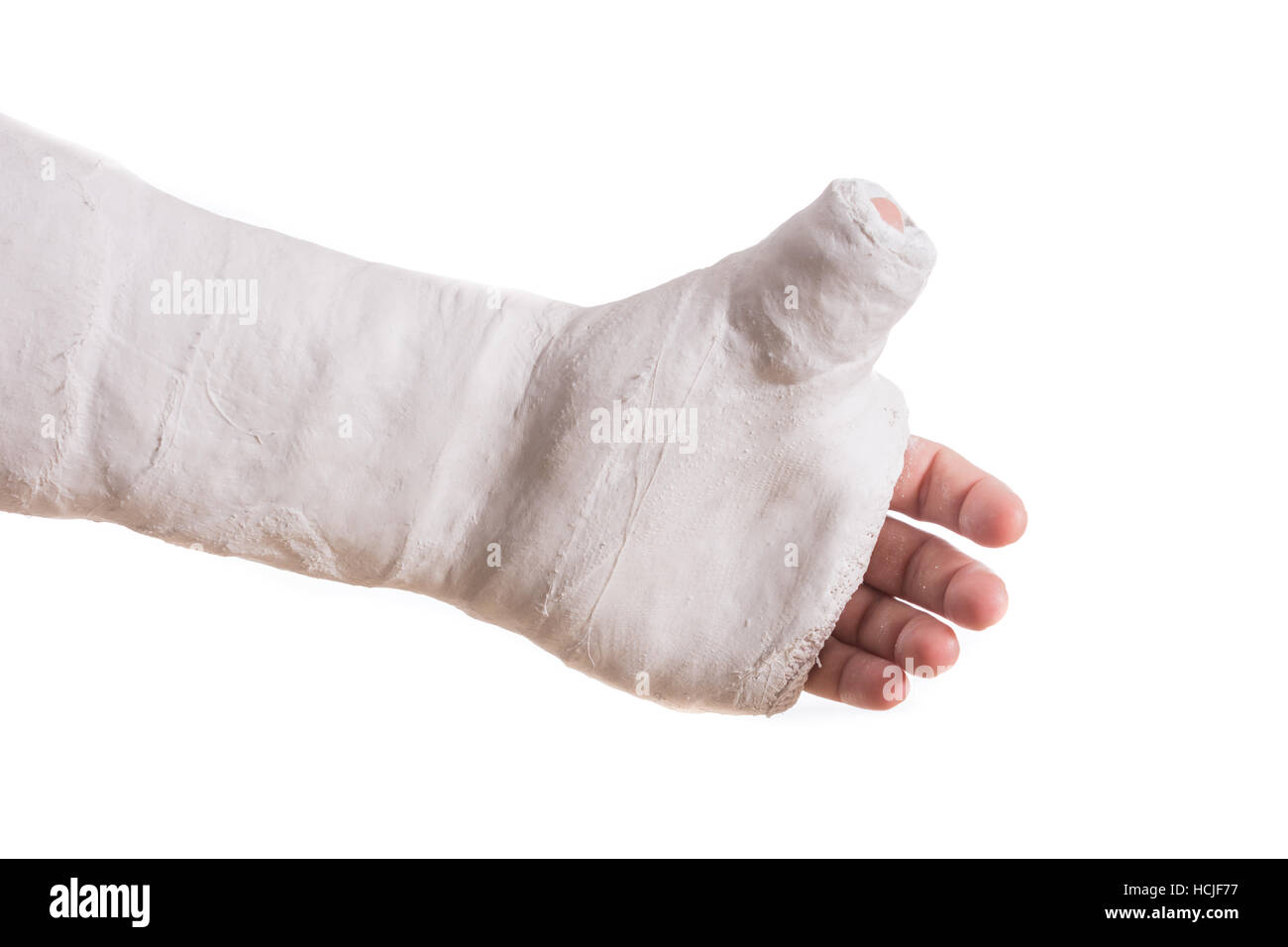 Thumb spica cast hires stock photography and images Alamy