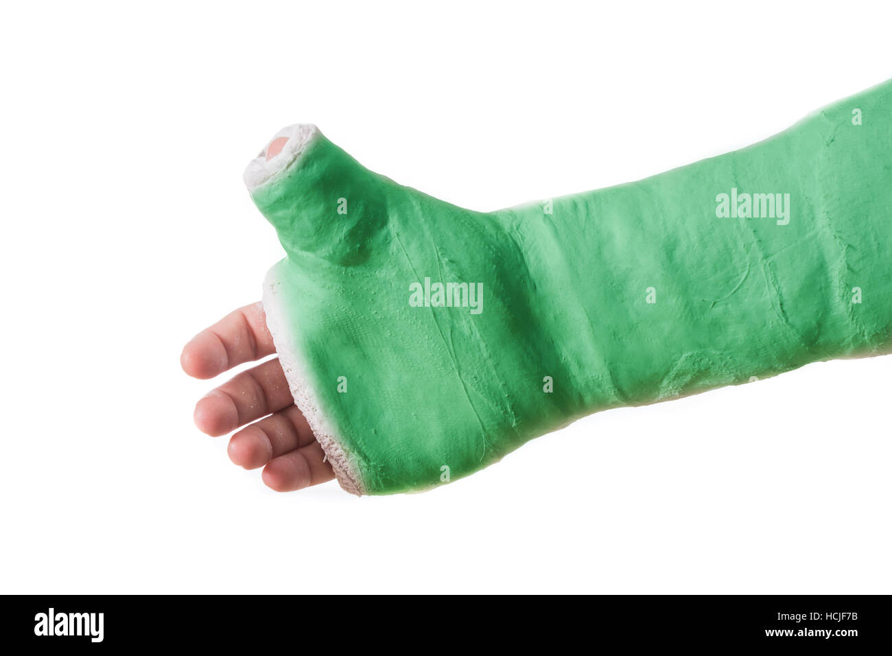 Close up of a green arm plaster / fiberglass cast  with the thumb extended in a thumbs-up shape, isolated on white Stock Photo