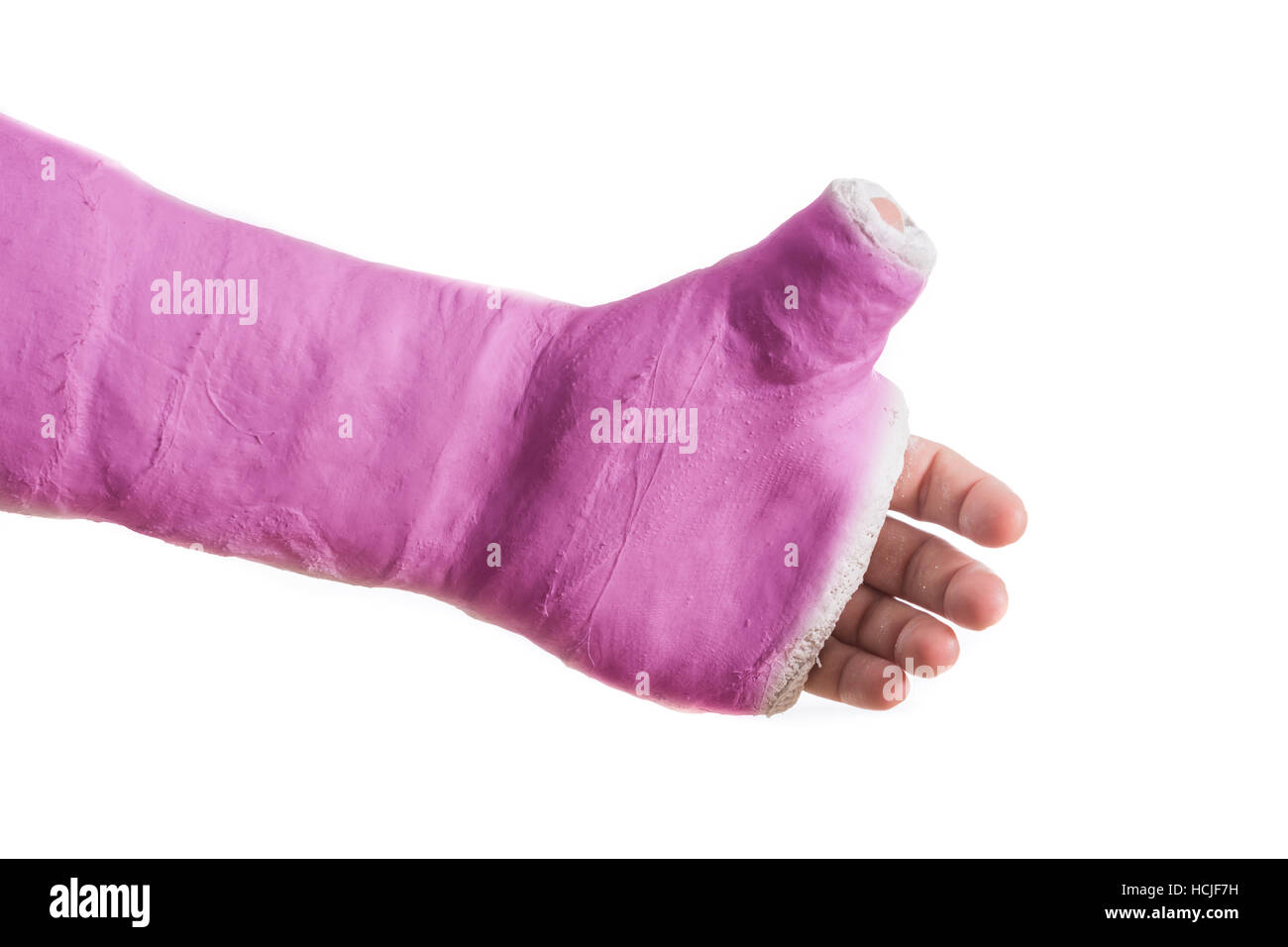 Close up of a pink arm plaster / fiberglass cast  with the thumb extended in a thumbs-up shape, isolated on white Stock Photo