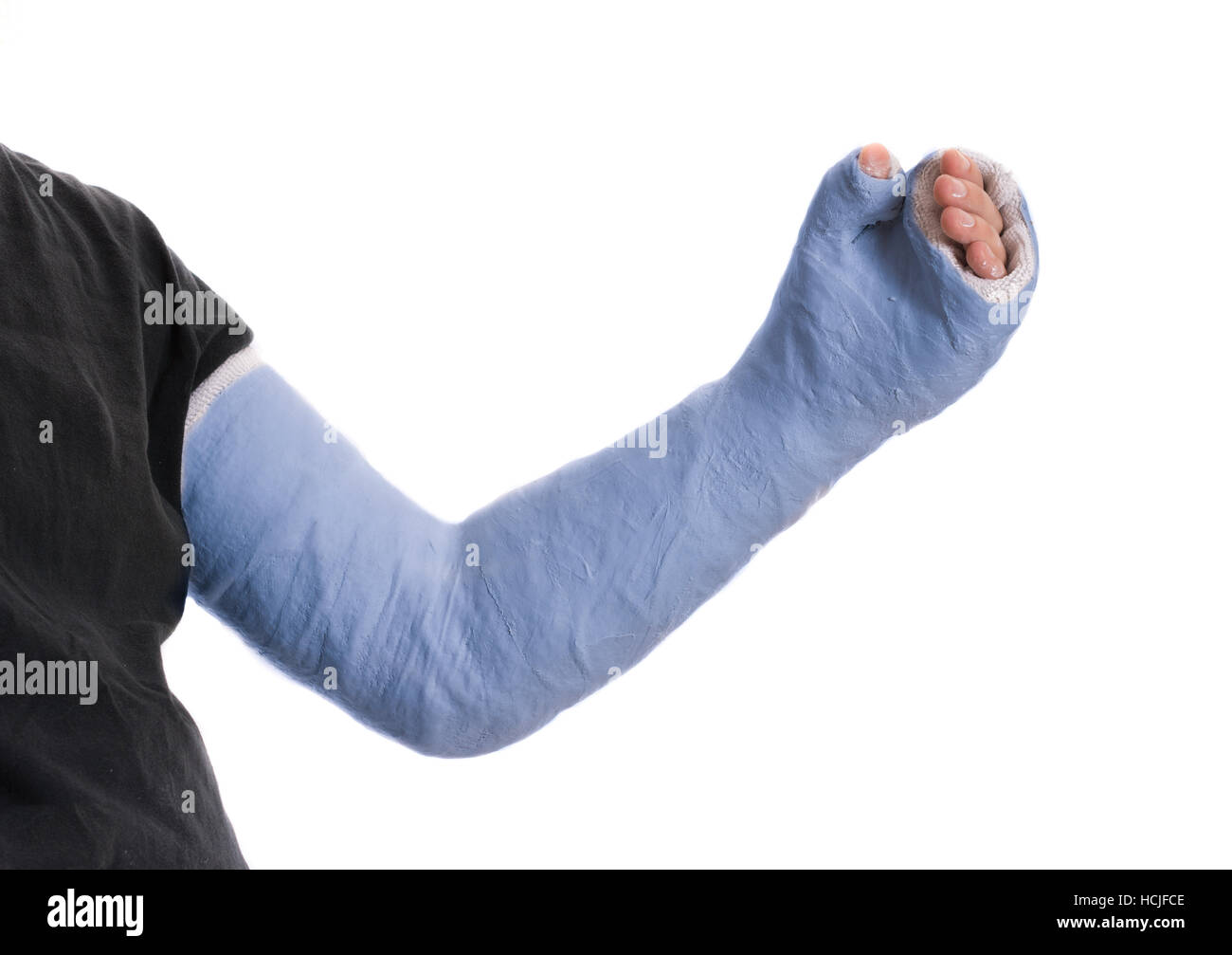 Close up of a young man's blue long arm plaster / fiberglass cast