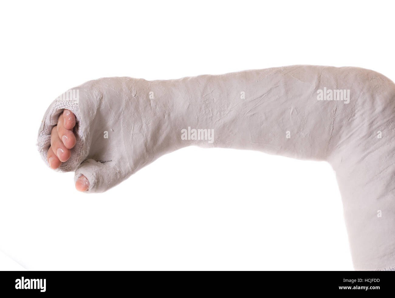 Young man with an arm and elbow in a white plaster / fiberglass cast holding an inline skate after a rollerblading accident Stock Photo