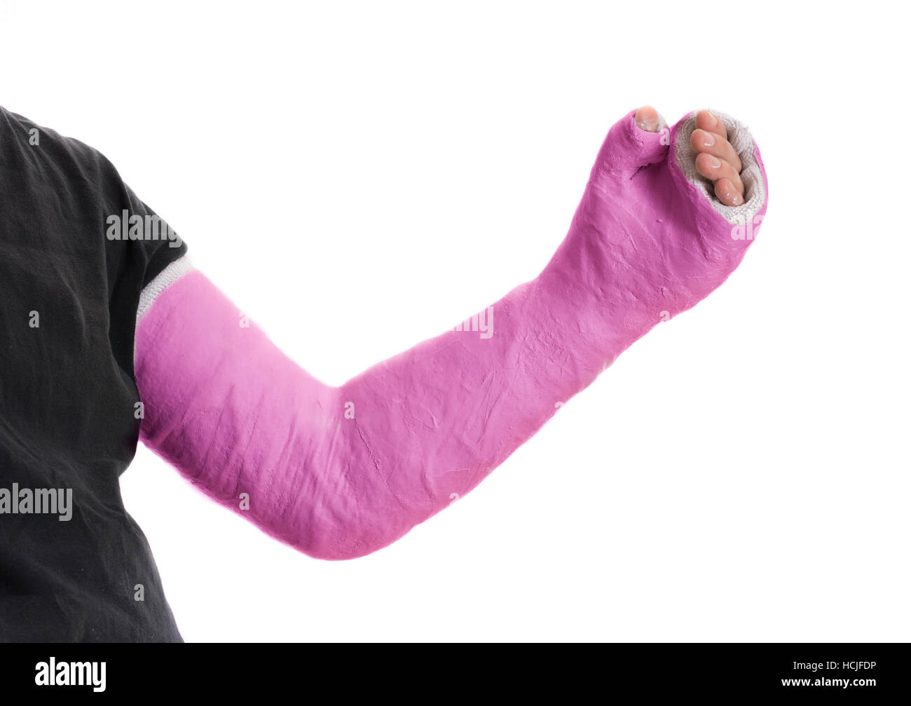 Close up of a pink long arm plaster / fiberglass cast covering the wrist, arm, and elbow after an accident, isolated on white Stock Photo