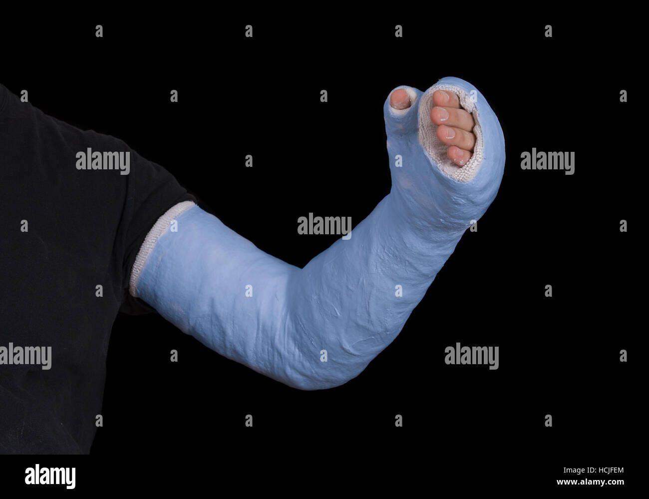Close up of a young man's blue long arm plaster / fiberglass cast