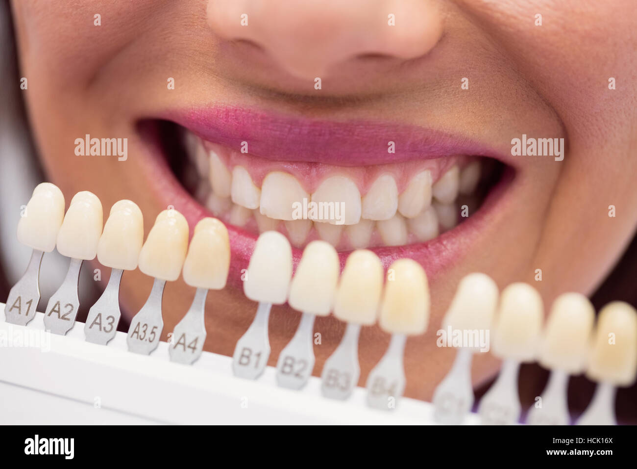 Teeth Color Shades Chart
