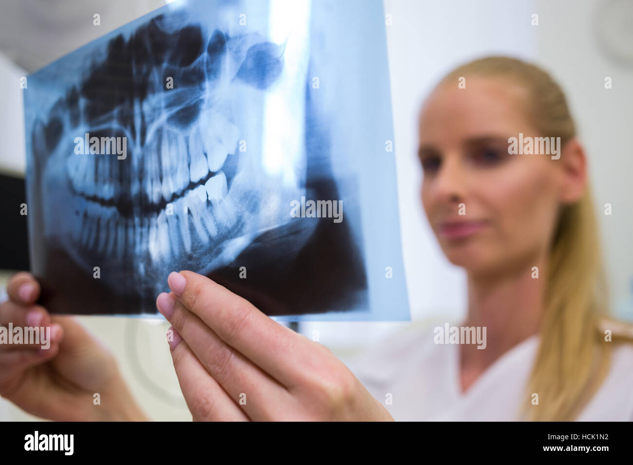 Dentist looking at dental xray plate Stock Photo Alamy