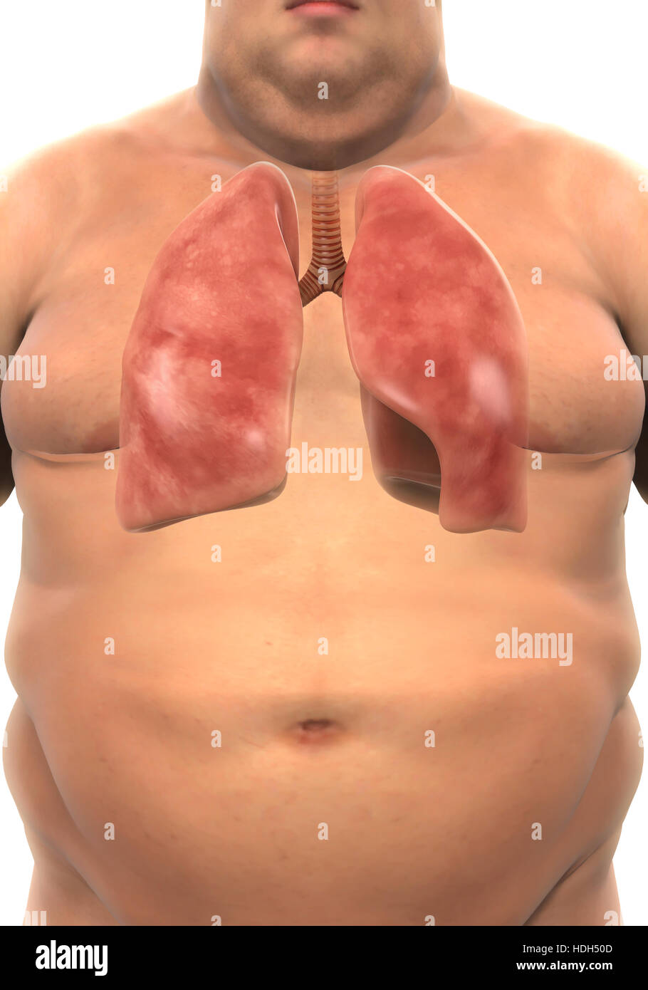 Respiratory System of Overweight Body Stock Photo