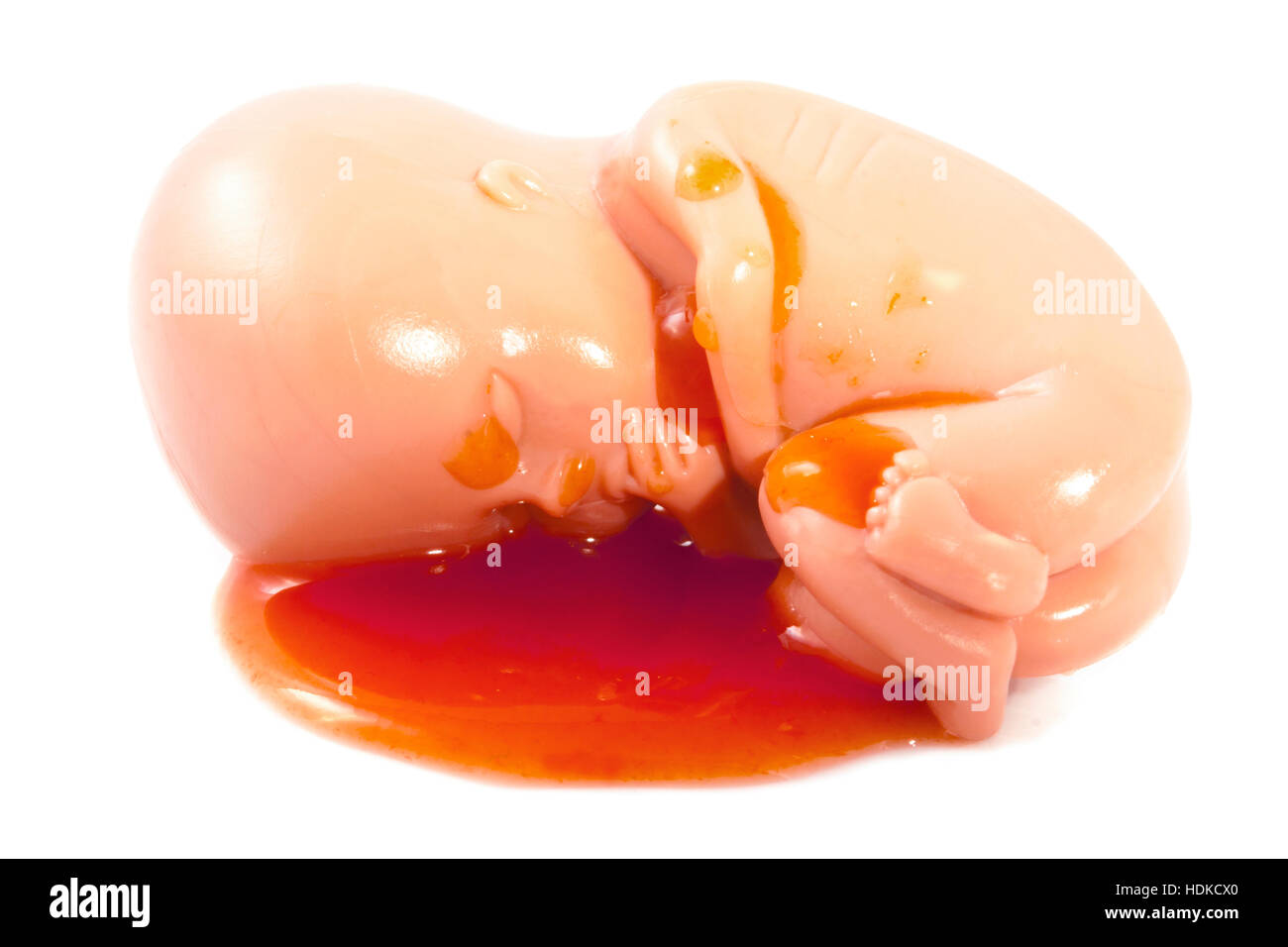 Foetus in blood isolated on a white background Stock Photo