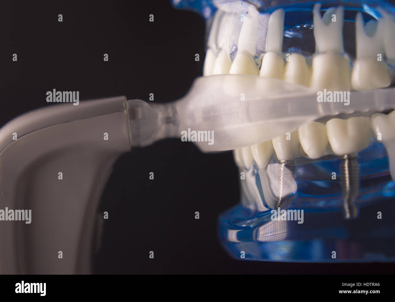 Vibrating dental device with invisible orthodontics Stock Photo Alamy