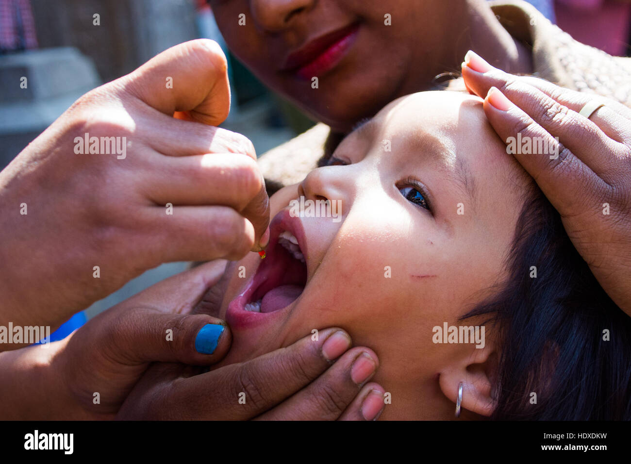 Young girl getting NGO distributed vitamin A drops in Kathmandu, Nepal Stock Photo