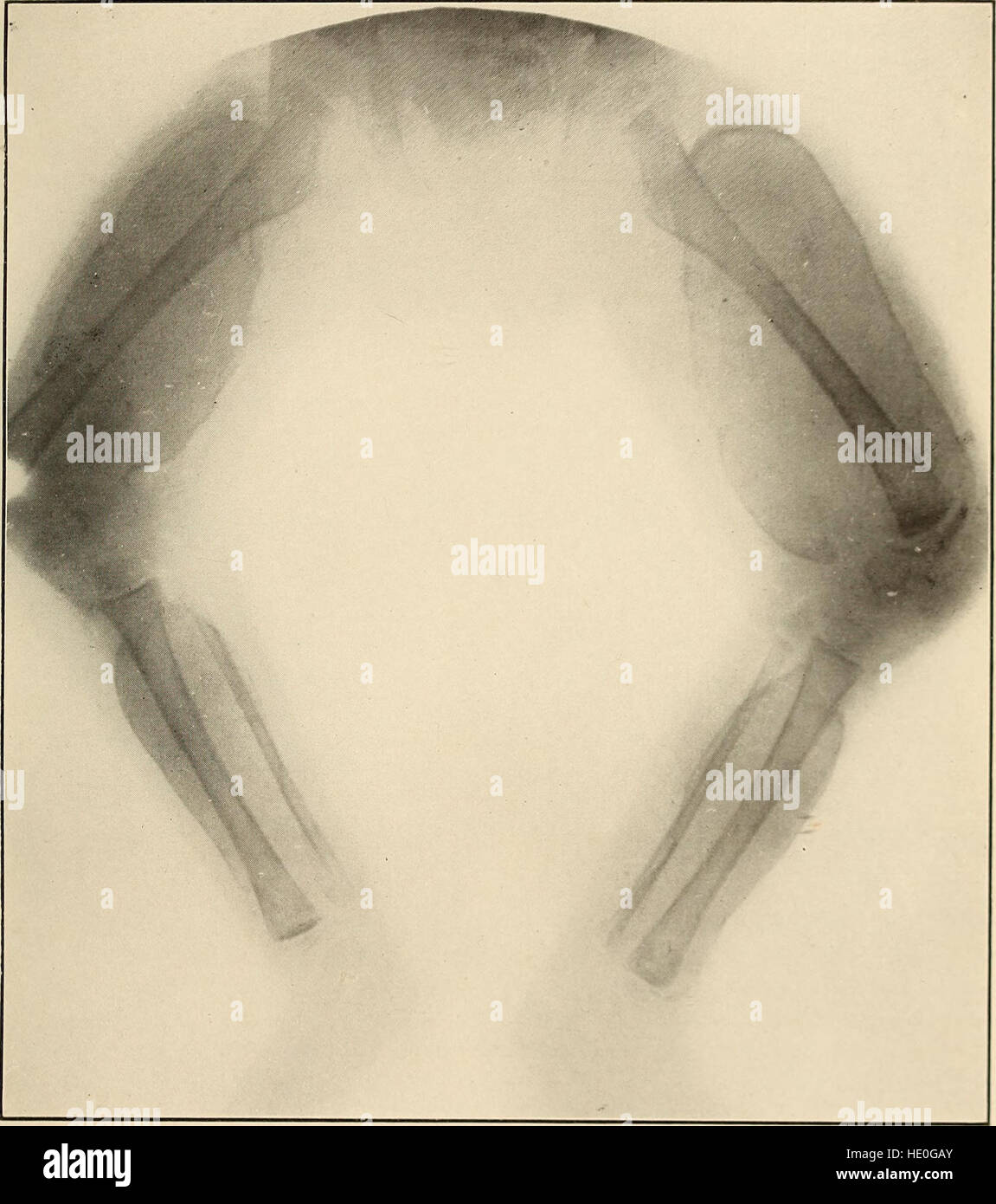 *Diseases of Infancy and Childhood* (1914) is a medical text focusing ...