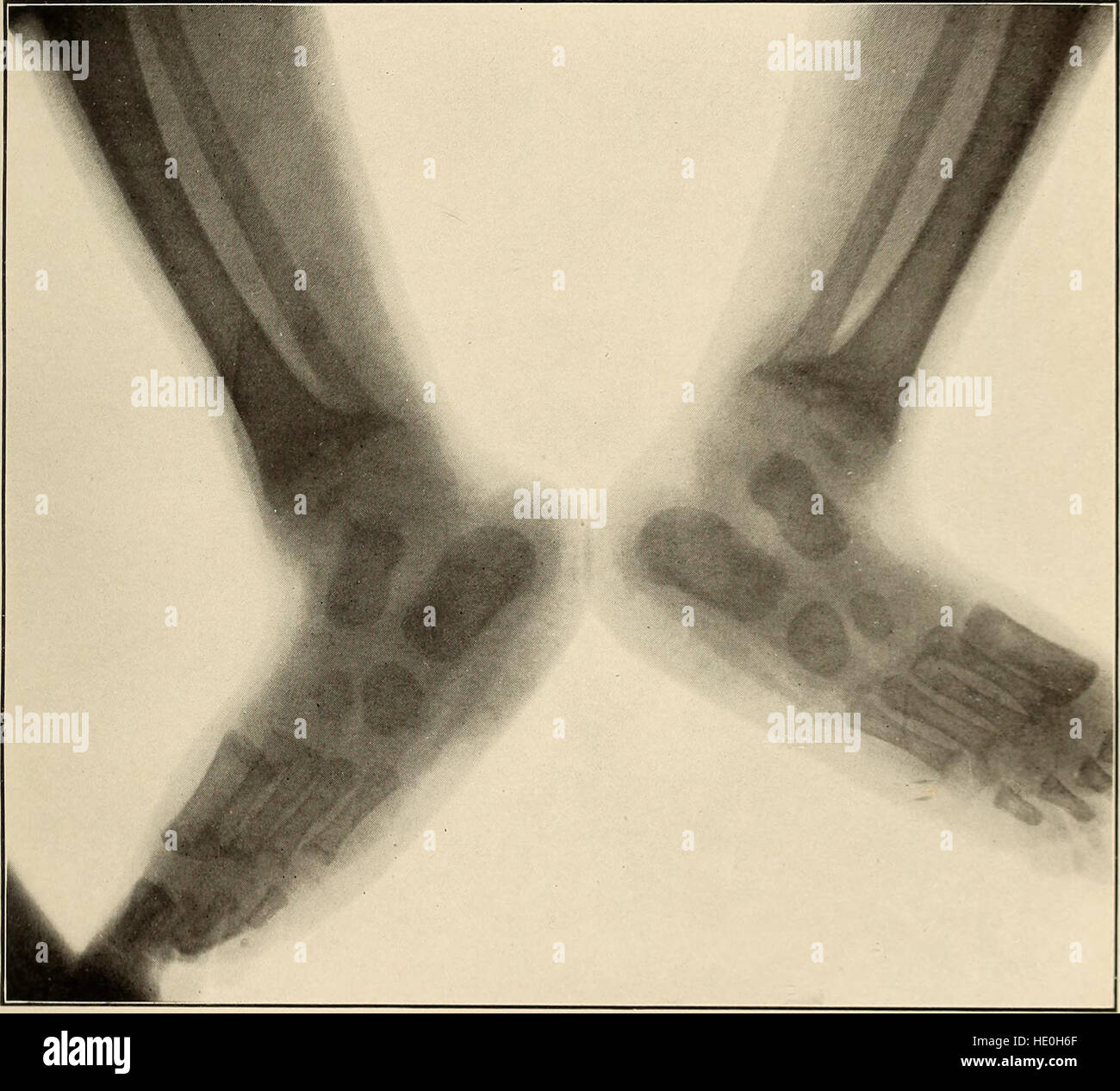 This 1914 text offers a detailed study of childhood and infant diseases