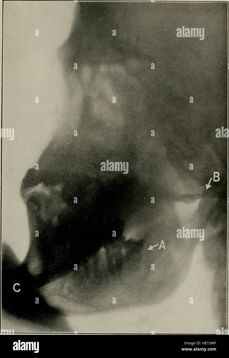 Elementary and dental radiography (1913 Stock Photo Alamy
