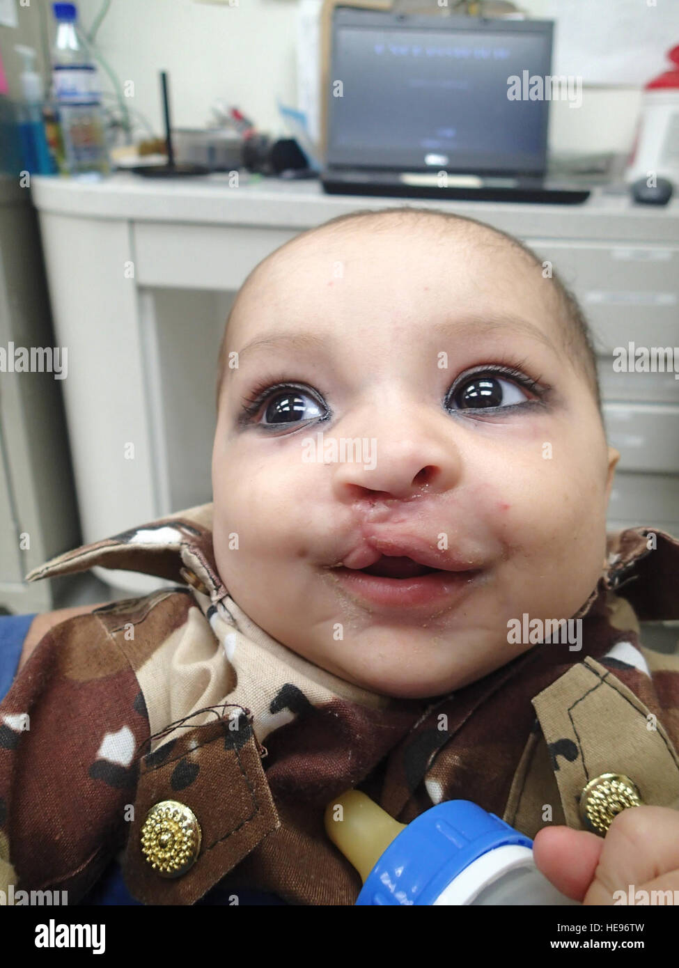 Maj. Jamie Swartz, 455th Expeditionary Medical Group ear, nose and throat surgeon, examines a the cleft lip on 6-month-old Afghan girl prior to performing surgery on her in the Craig Joint Theater Hospital's operating room at Bagram Air Field, Afghanistan. She said this surgery was one the most memorable in her career thus far. Swartz is an otolaryngologist deployed from Langley Air Force Base, Va. Maj. Jamie Swartz) Stock Photo