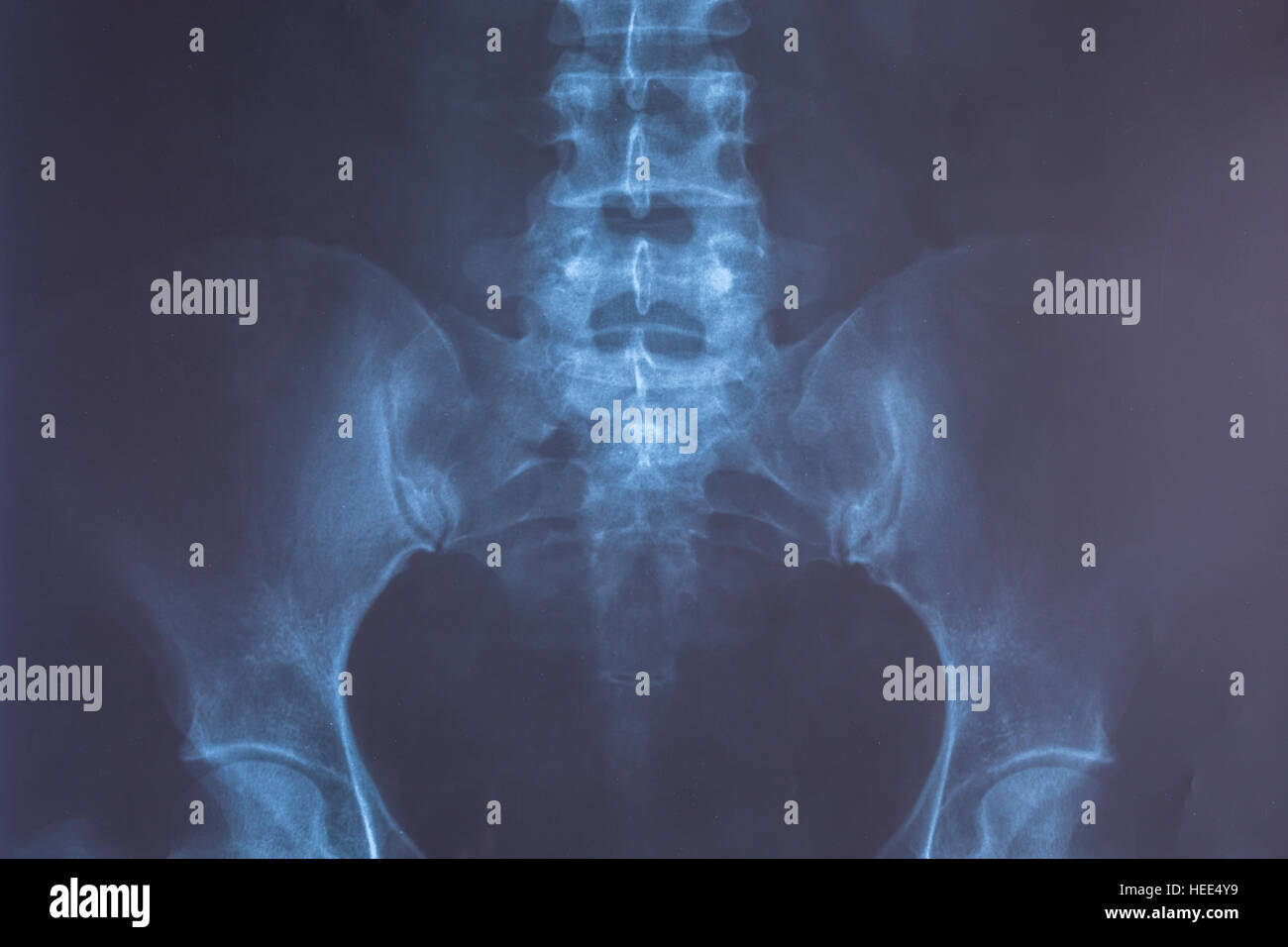 Close up X-Ray image of human for a medical diagnosis Stock Photo