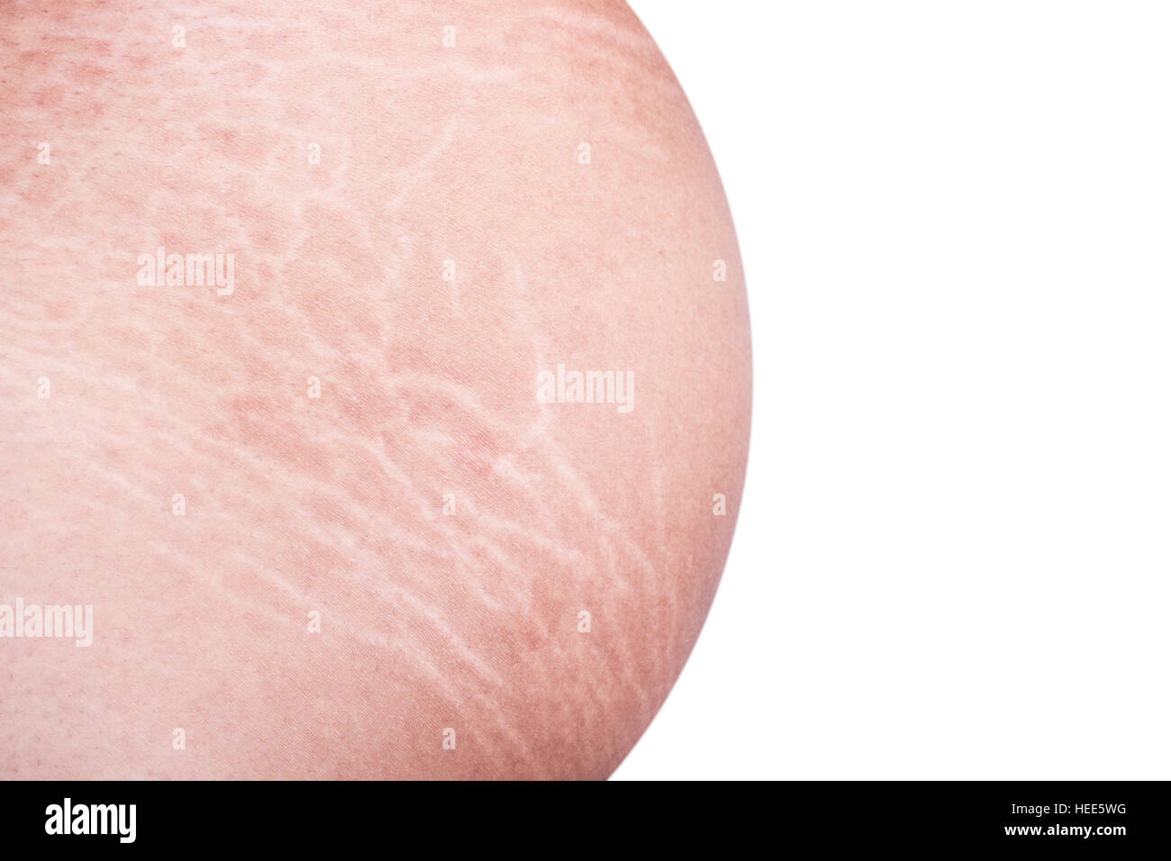 Macro stretch marks of skin on the belly isolated on white background Stock Photo