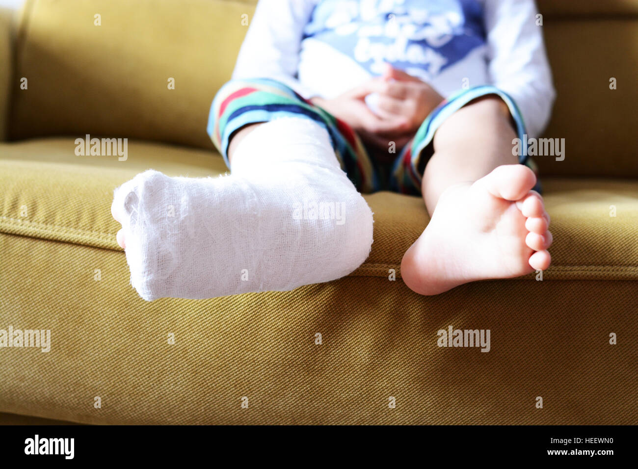 Little child with plaster bandage on leg heel fractured Stock Photo