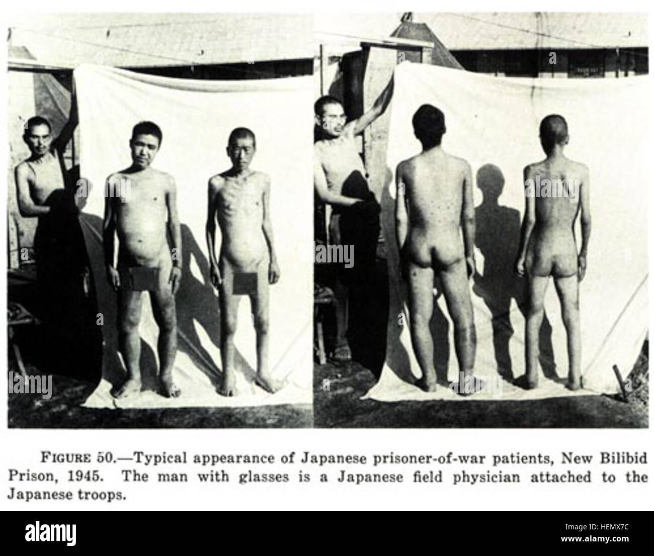 appearance of Japanese prisoner-of-war patients, New Bilibid Prison, 1945. 