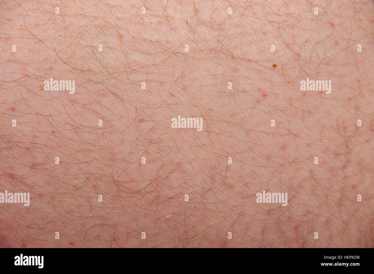 Caucasian male skin, here upper leg. Stock Photo