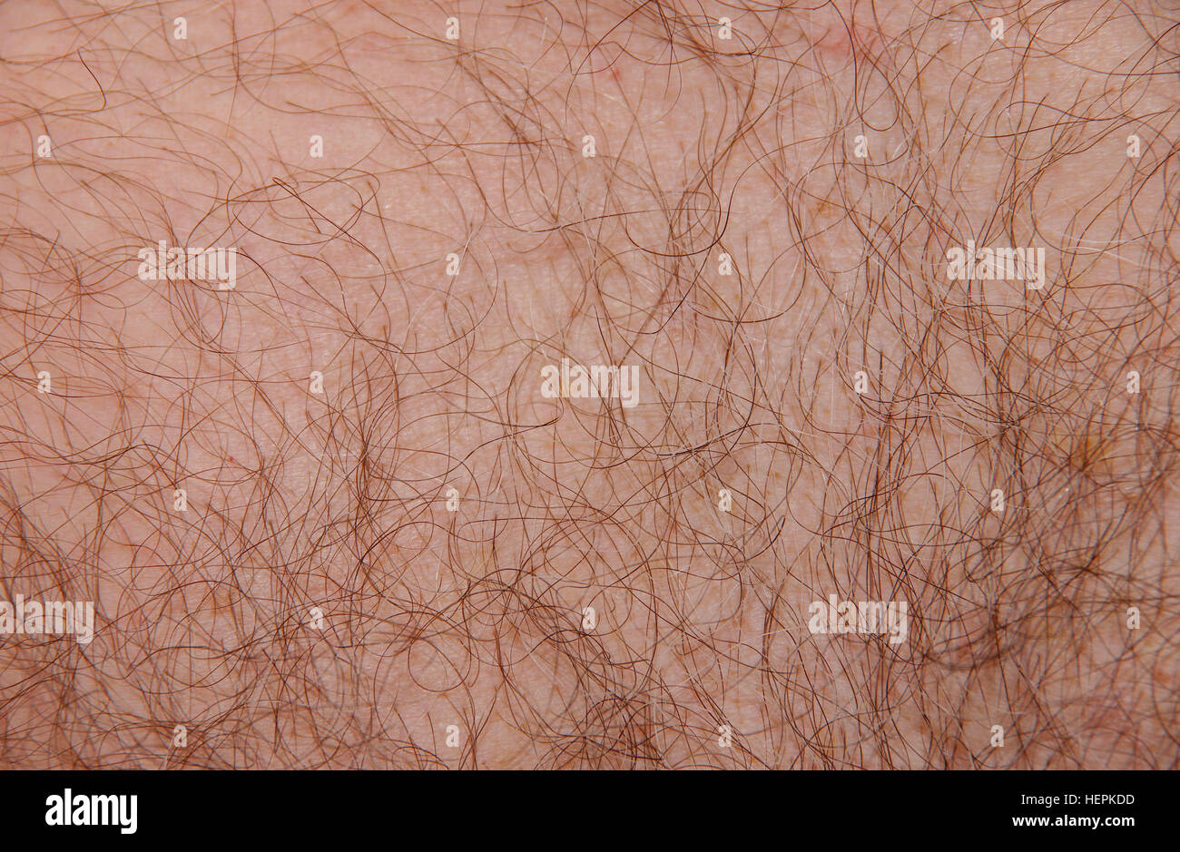 Caucasian male skin, here part of the chest. Stock Photo