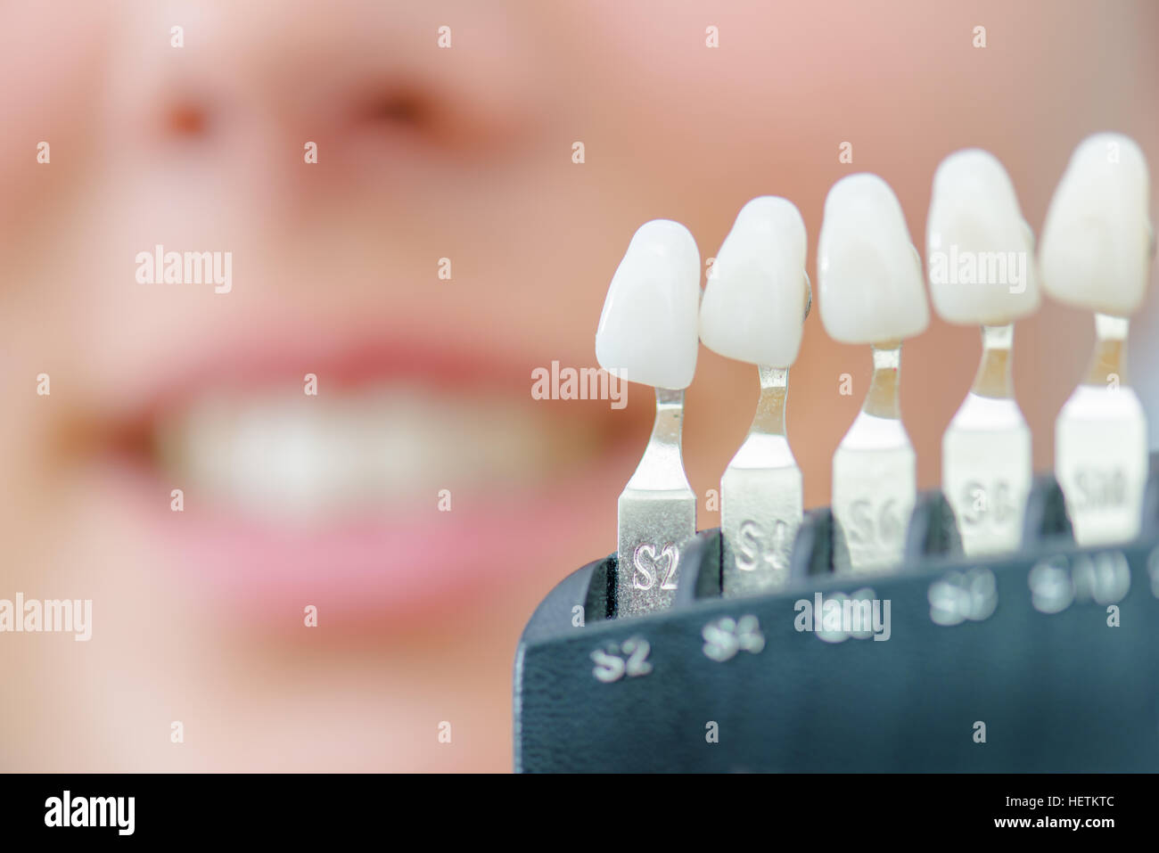 Numbered individual false teeth for colour match Stock Photo Alamy