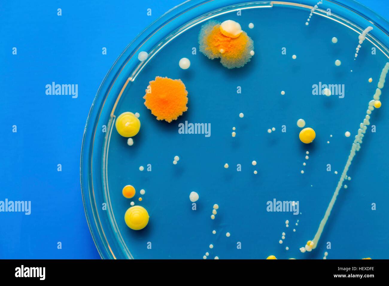 Bacteria in a petri dish against a blue background Stock Photo - Alamy