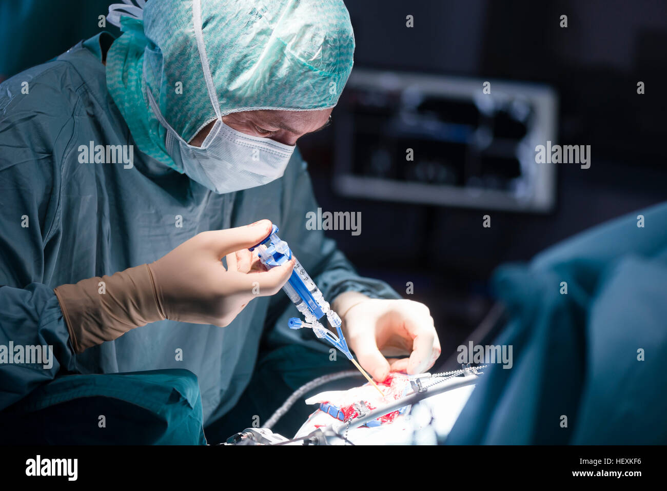 Neurosurgeon closing operation wound Stock Photo Alamy