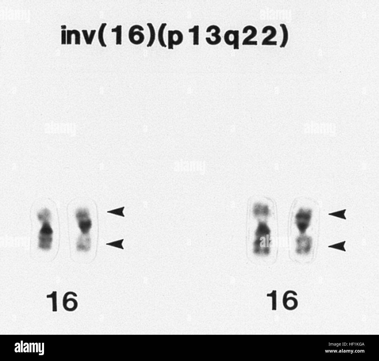 Chromosome inversion Black and White Stock Photos & Images - Alamy