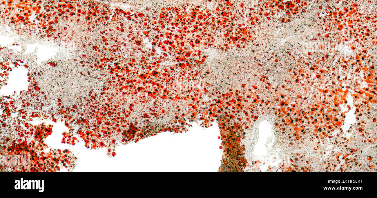 full frame abstract microscopic detail of a human fatty liver Stock Photo