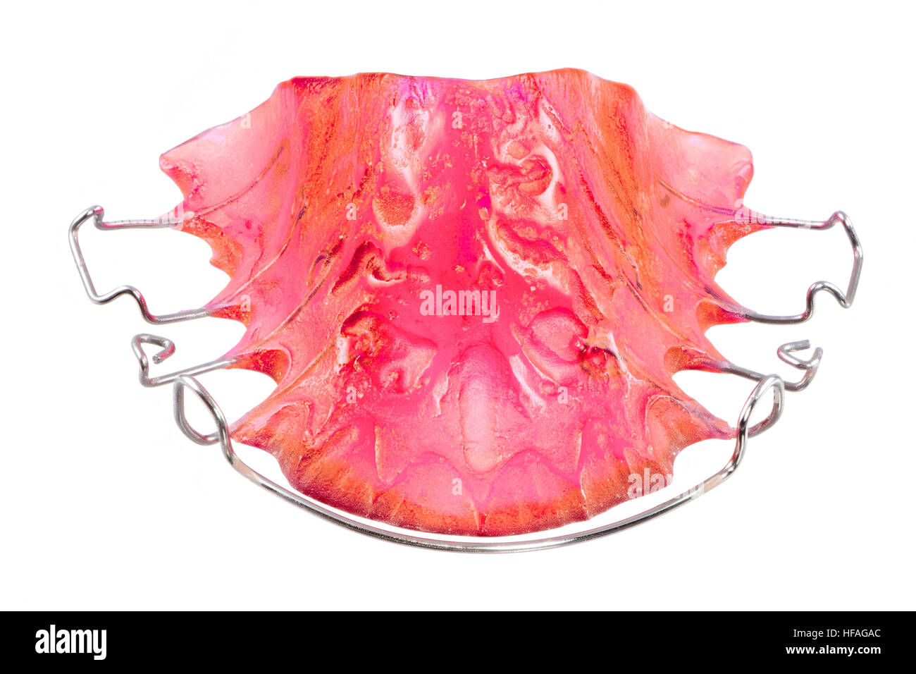 Orthodontics hires stock photography and images Alamy