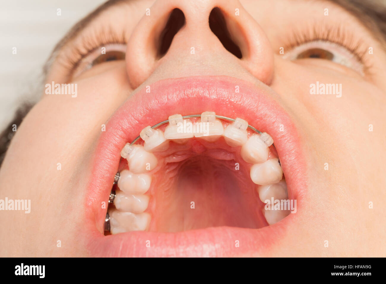 Зубы внутри рта. Здоровая ротовая полость.